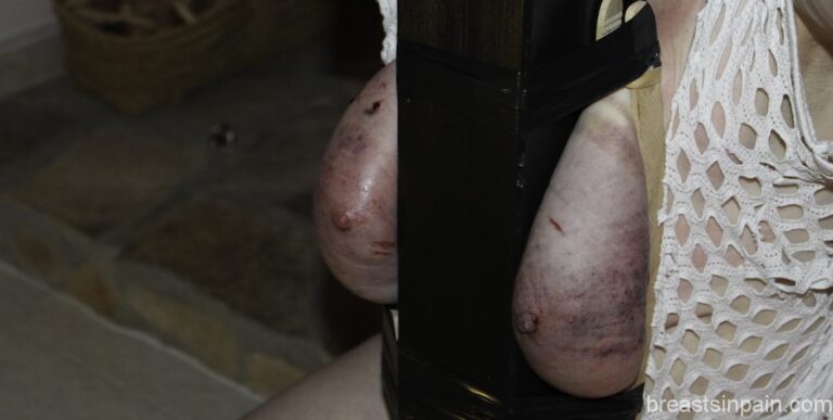 Brutal Tit Whipping for Tanja