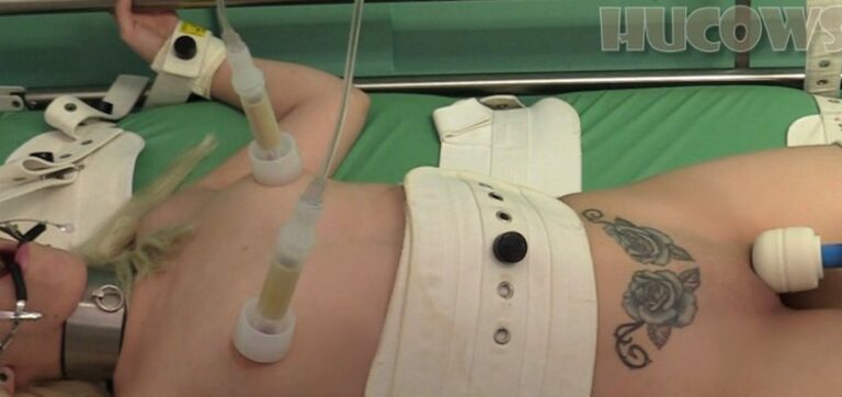 Liz – pump treatment