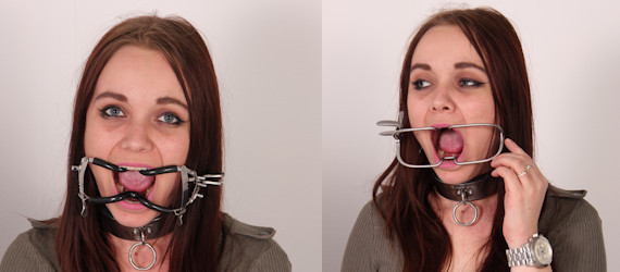 Mouth spreaders!