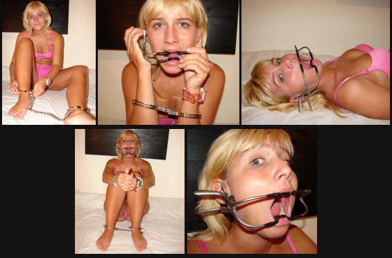 Mouth spreader